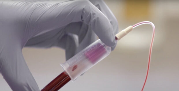 Some blood tests promise to detect cancer. What to know.